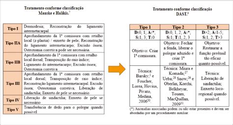 Emocao De Fenda De Volta Revisao