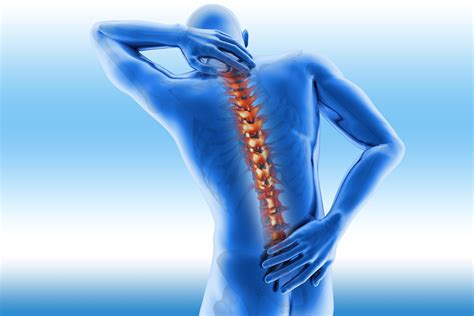 Poker Coluna Vertebral Espondilite Anquilosante