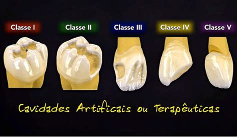 Slot Cavidade Odontologia